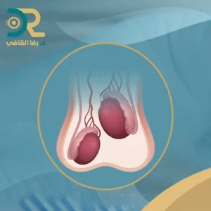 شكل الخصية المعلقة بالصور