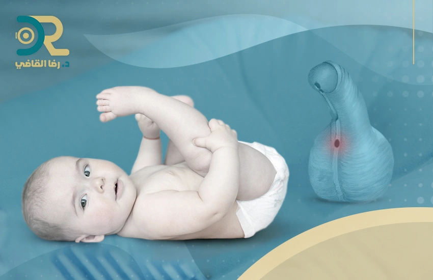 لا تتجاهل علاج الإحليل السفلي من الدرجة الأولى!