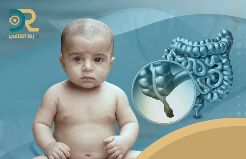 ما هي الزائدة الدودية وكيف تميز أعراضها عند طفلك؟