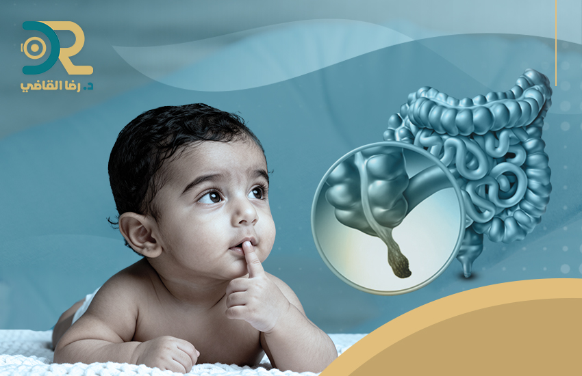 أسباب التهاب الزائدة الدودية