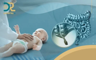 إليك علاج التهاب الزائدة الدودية ولماذا لا يحتمل التأجيل