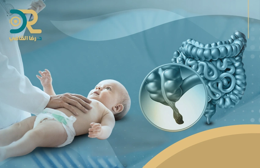 علاج التهاب الزائدة الدودية