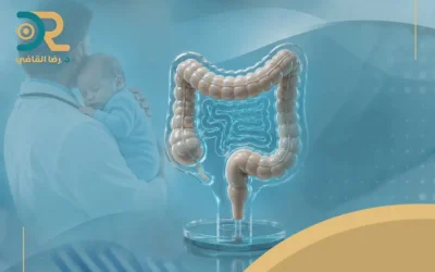 إليك أفضل علاج للقولون في حالات العيوب الخلقية