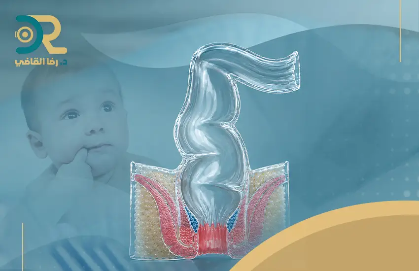 ما هي فتحة الشرج؟ كل ما تحتاج معرفته عن تكوينها وأمراضها عند الأطفال