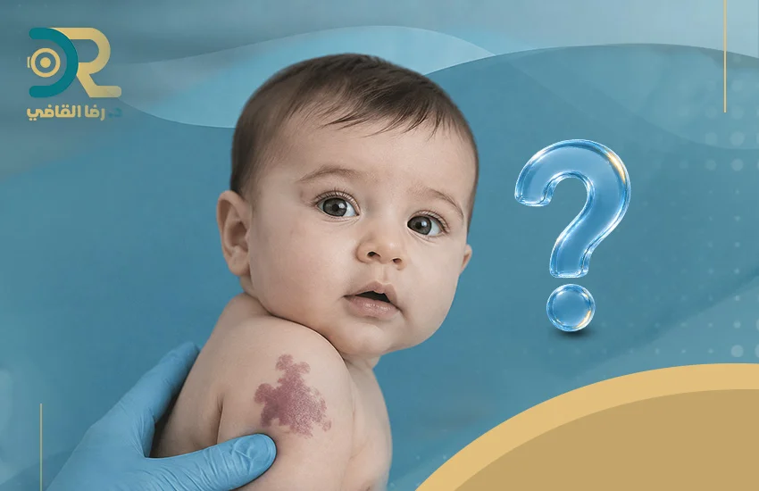 أسباب الوحمات الدموية عند الأطفال